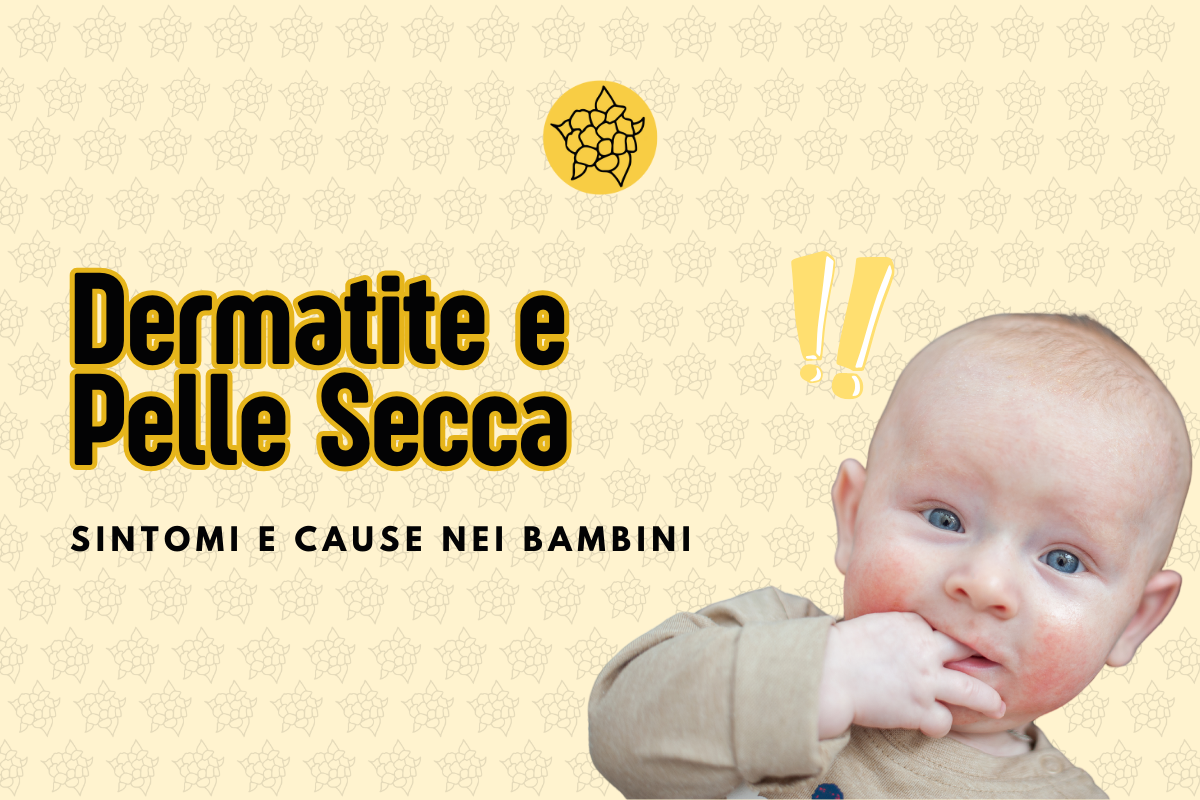 Dermatite da Pelle Secca nei Bambini: Cause, Sintomi e Soluzioni