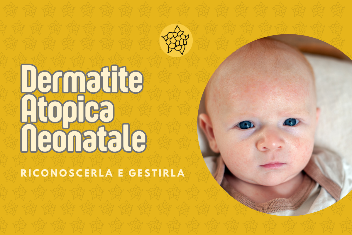 Dermatite Atopica Neonatale