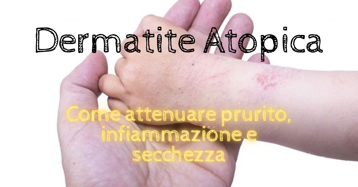 Come attenuare prurito, infiammazione e secchezza della pelle del tuo bambino