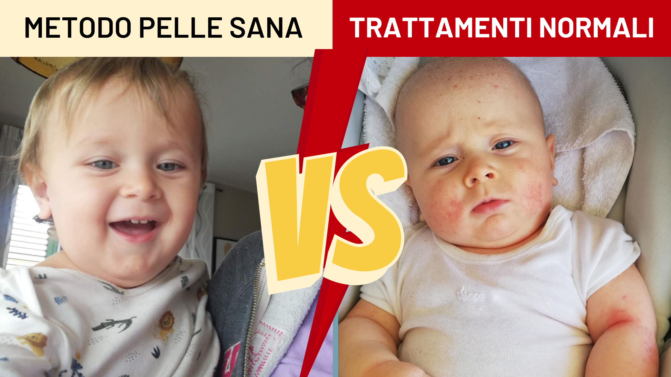 Come combattere la Dermatite Atopica: Trattamenti Standard VS rimedi e strategie di Metodo Pelle Sana