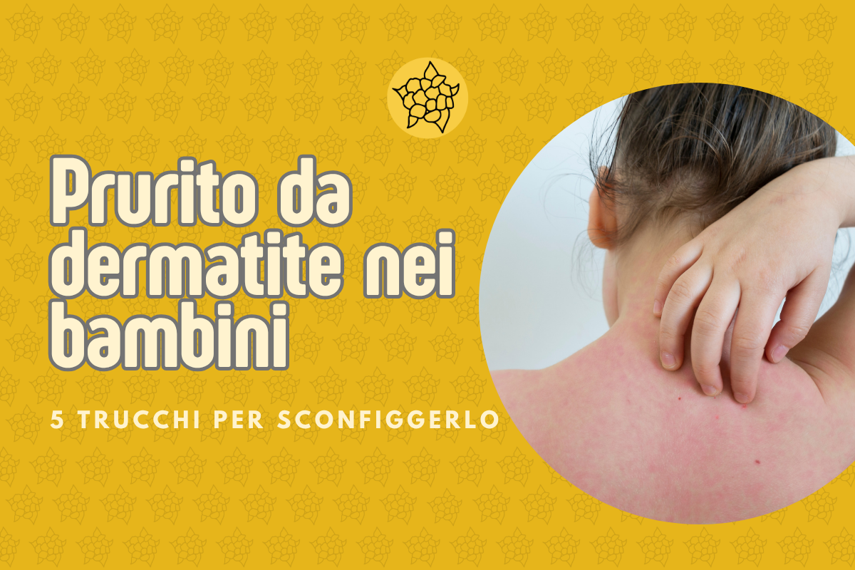 prurito pelle bambini dermatite