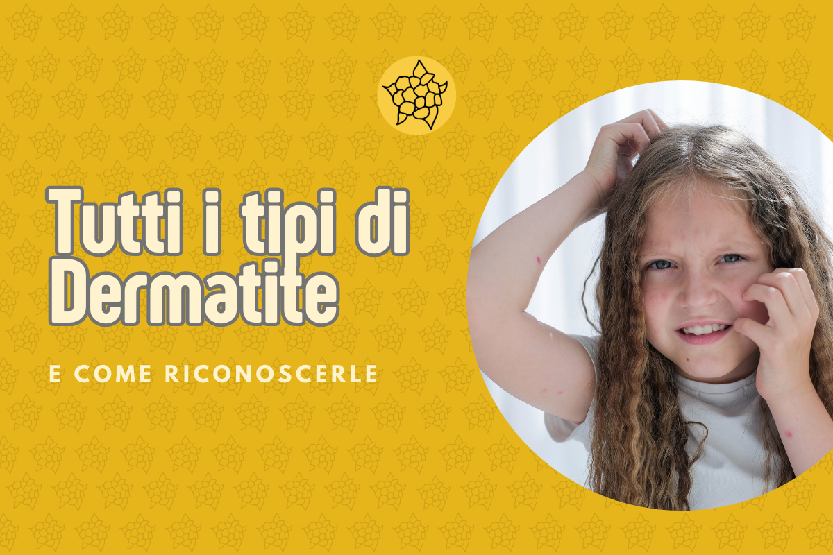 Tipi di Dermatite: Come Riconoscerli e Stare Meglio