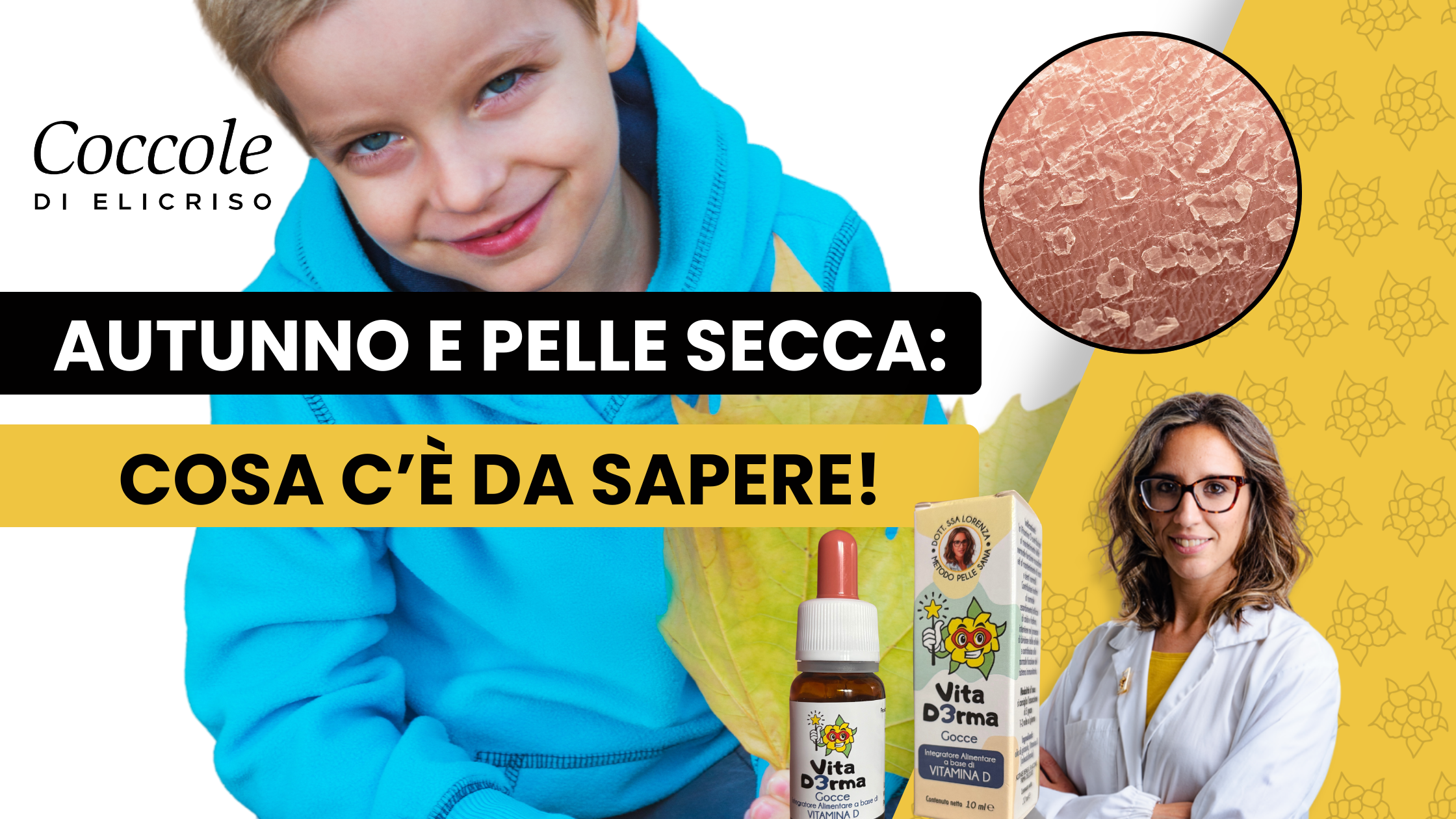 Pelle secca e irritata in Autunno?Ecco i nostri consigli pratici per il tuo bambino e il Kit Integra Vita