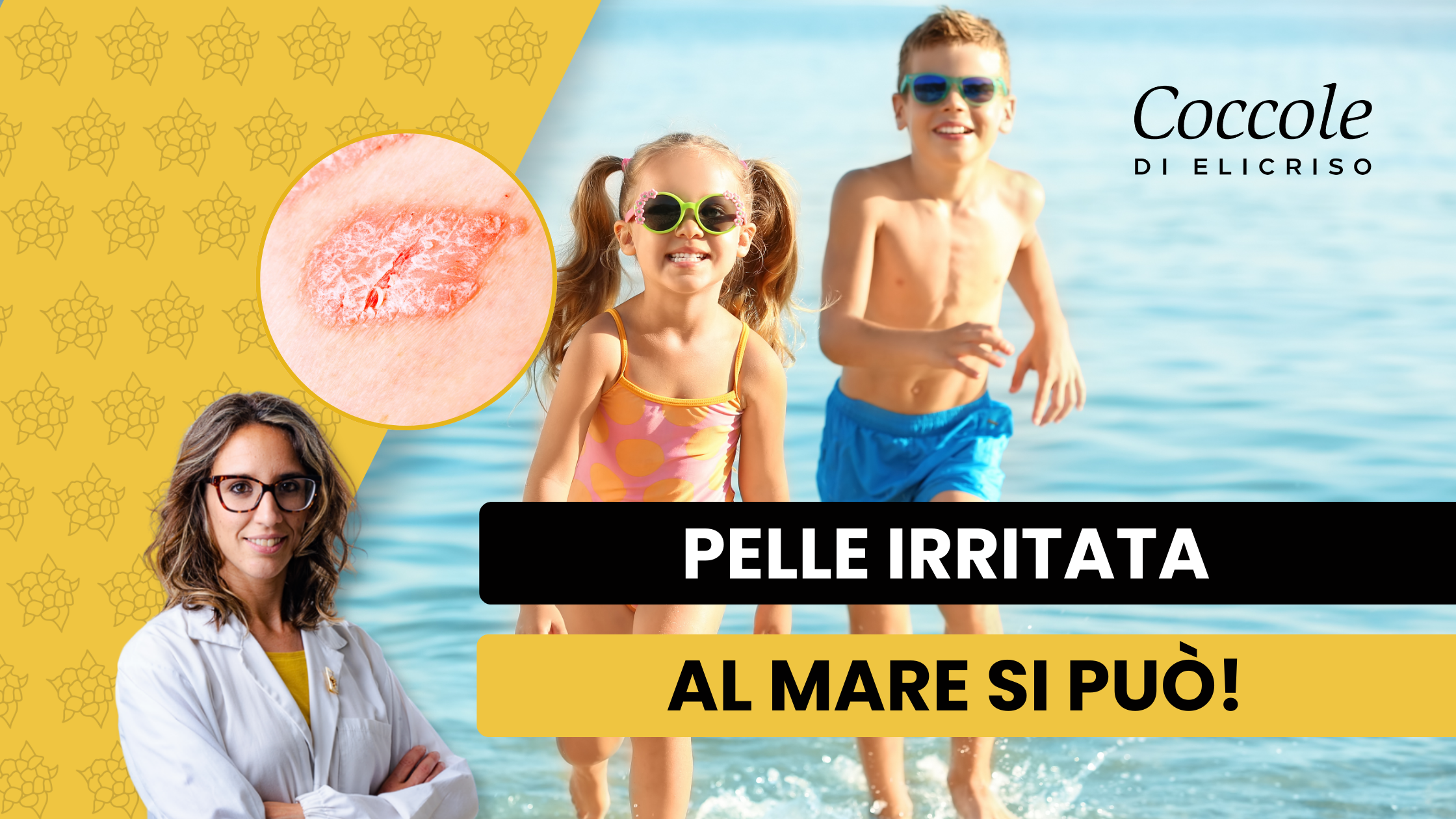 Mare e Irritazioni: 5 cosa che porto con me in spiaggia