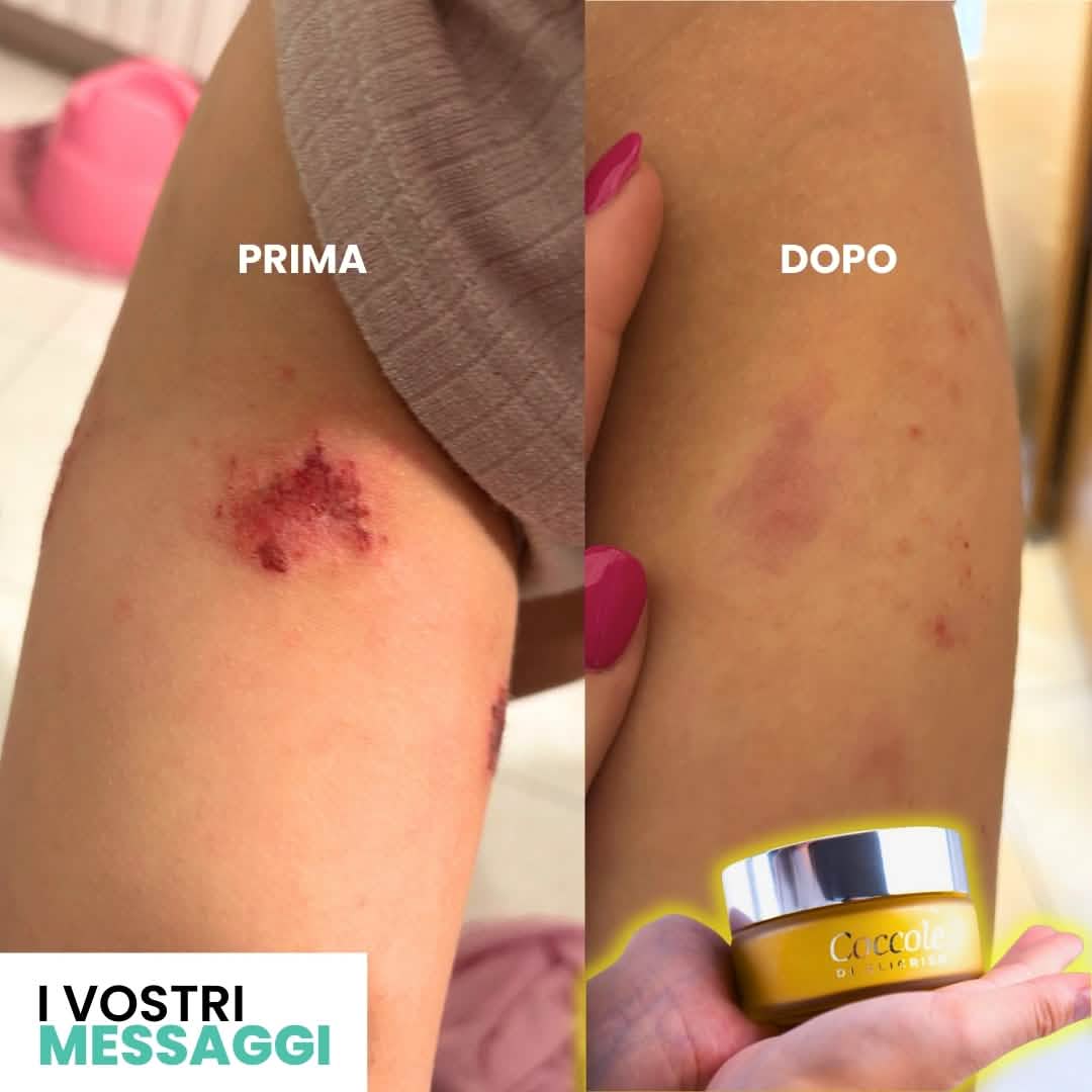 Coccole di Elicriso maxi pack